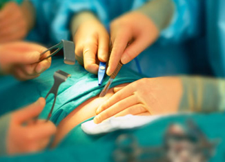 Πρωτοποριακή Επέμβαση Αφαίρεσης Ινομυώματος