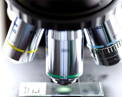 Σημαντική Ανακάλυψη για Έγκαιρη Διάγνωση Καρκίνου του Παγκρέατος