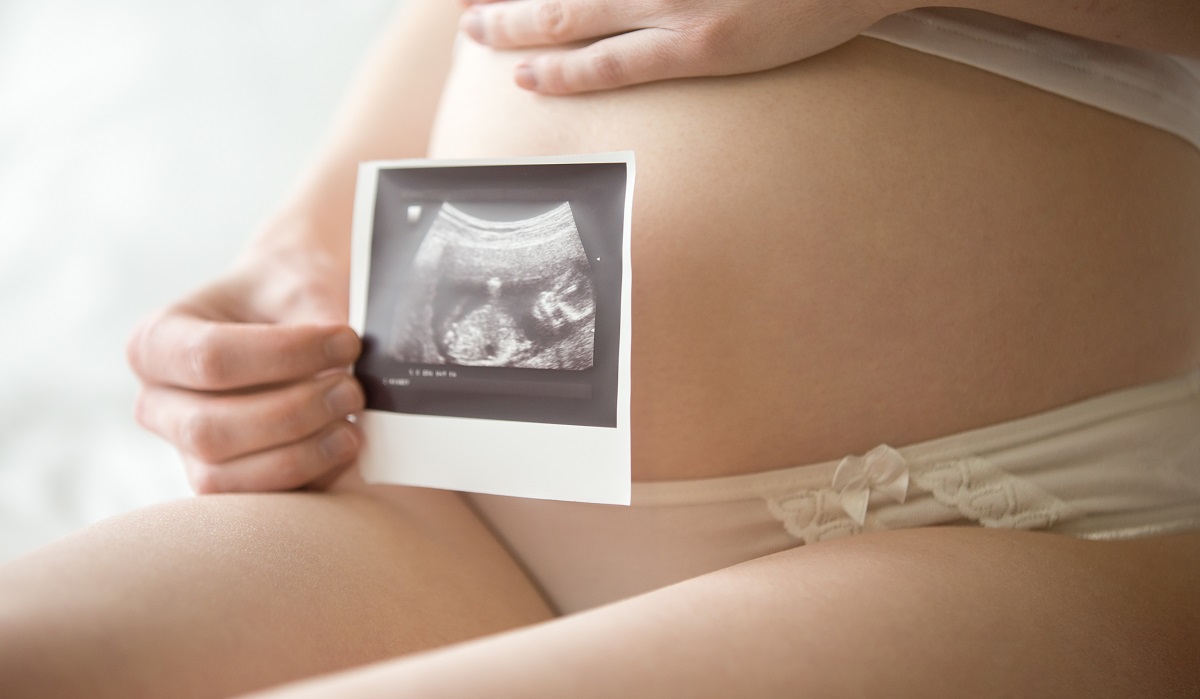 Close-up of belly of young pregnant model showing ultrasonic image of her baby. Future mom on her second trimester holding ultrasound scan of her child. Maternity concept