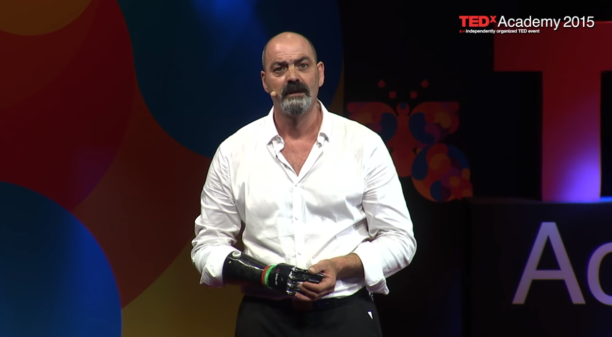 Video: Ο βιονικός άνθρωπος