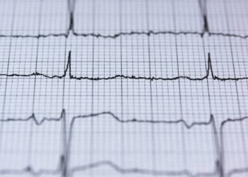 blur-chart-check-up-curve-insurancedaily