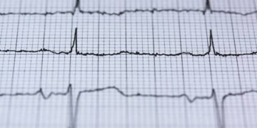 blur-chart-check-up-curve-insurancedaily