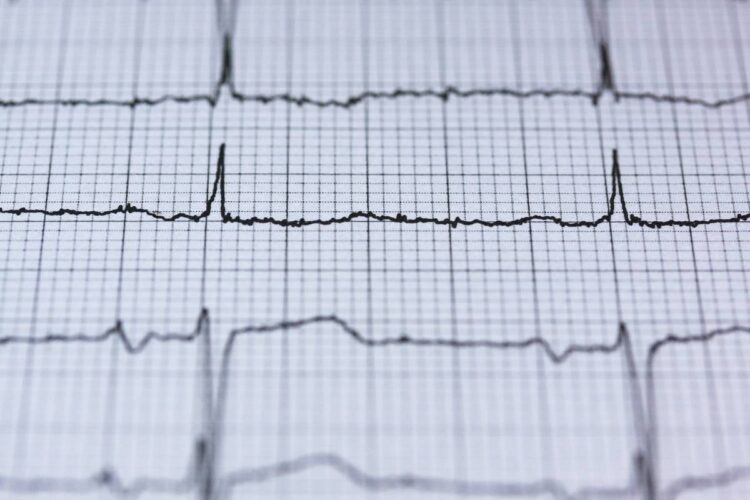 blur-chart-check-up-curve-insurancedaily
