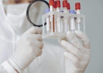 person-holding-test-tube-rack