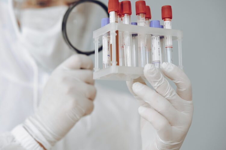 person-holding-test-tube-rack