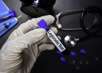 Κίνδυνος ανάπτυξης του βακτηριδίου της νόσου των λεγεωνάριων από το… lockdown