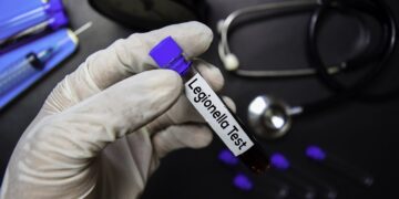 Κίνδυνος ανάπτυξης του βακτηριδίου της νόσου των λεγεωνάριων από το… lockdown