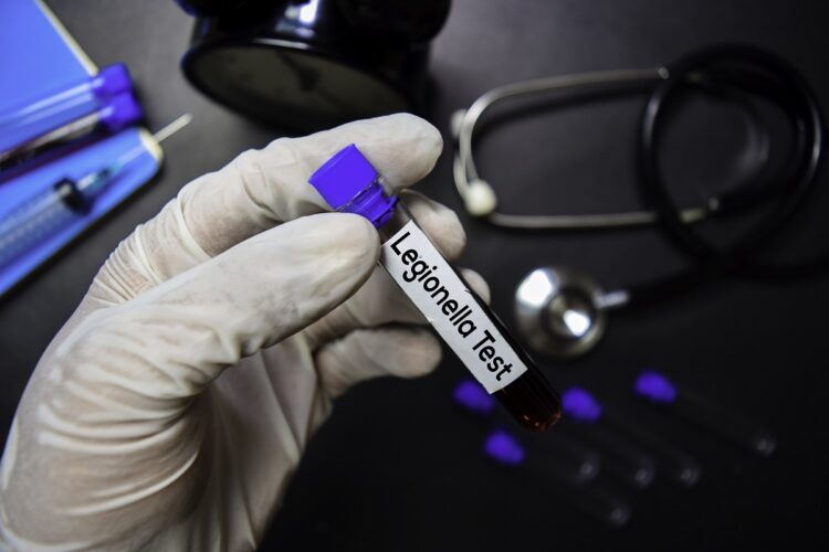 Κίνδυνος ανάπτυξης του βακτηριδίου της νόσου των λεγεωνάριων από το… lockdown