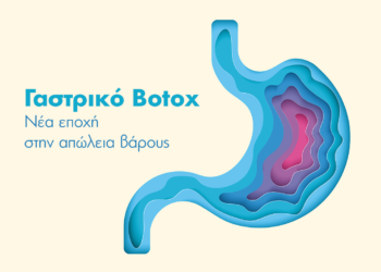 ΙΑΣΩ: Γαστρικό Botox, η σύγχρονη μη επεμβατική μέθοδος για απώλεια βάρους