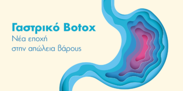 ΙΑΣΩ: Γαστρικό Botox, η σύγχρονη μη επεμβατική μέθοδος για απώλεια βάρους