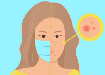 Maskne concept. Infographic vector illustration with definition of maskne - acne or irritation caused by wearing protective face mask. Female portrait, woman character with maskne closeup.