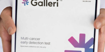 Ασφαλιστική εταιρεία παρέχει πρόσβαση σε τεστ ανίχνευσης καρκίνου