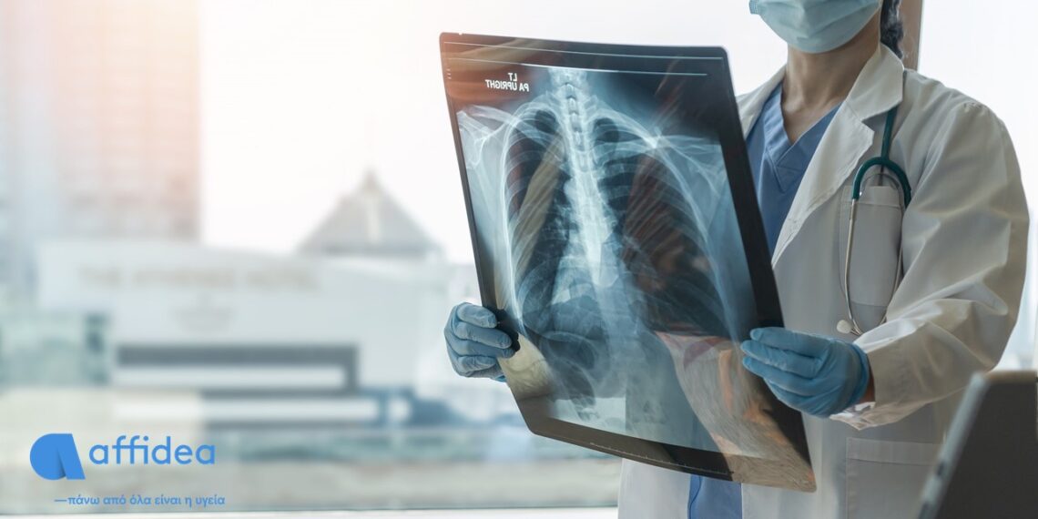 Παγκόσμια Ημέρα κατά του Καρκίνου: Ο ρόλος της ιατρικής απεικόνισης στην ογκολογία