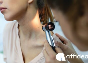 Δερματοσκόπηση σπίλων: Έγκαιρη διάγνωση του καρκίνου του δέρματος