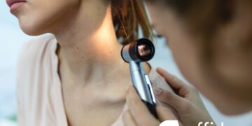 Δερματοσκόπηση σπίλων: Έγκαιρη διάγνωση του καρκίνου του δέρματος