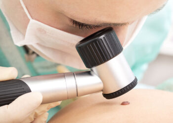 Η εξέταση-κλειδί για την έγκαιρη διάγνωση του καρκίνου του δέρματος