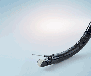 endoskopiko-yperixografima-eus-general2-1024gif